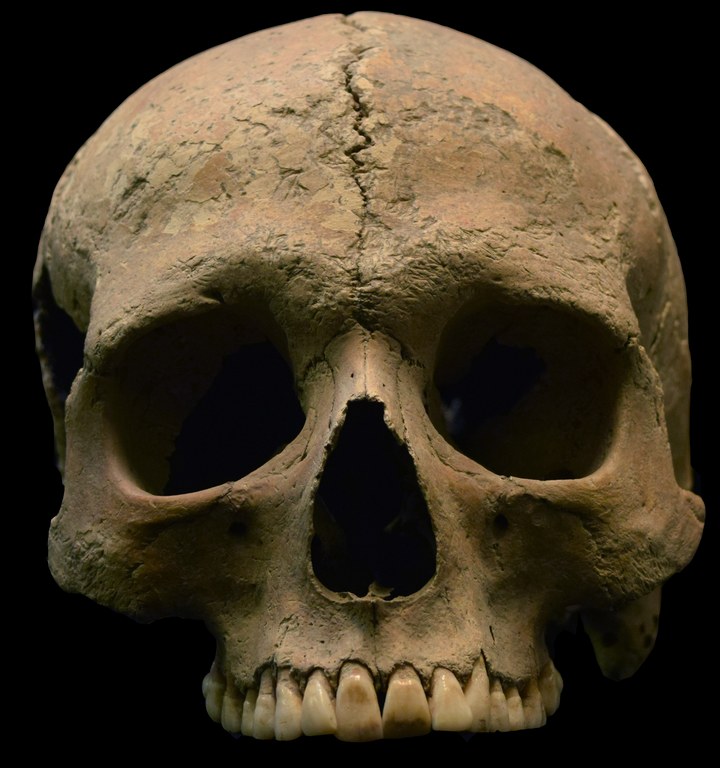 Frontal view of the above skull. This skull of an adult male (approx. 20-25 years in age), was recovered from the Velia Necropolis (1st-2nd c. C.E). Image credit: Luigi Pigorini National Museum of Prehistory and Ethnography in Rome